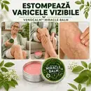 VenoCalm Miracle Balm pentru vene vizibile