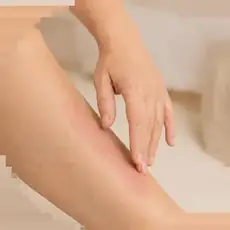 Se aplică balsamul pe gambă